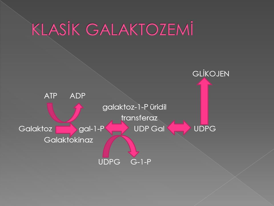 KLASİK GALAKTOZEMİ GLİKOJEN ATP ADP galaktoz-1-P üridil transferaz Galaktoz gal-1-P UDP Gal UDPG Galaktokinaz UDPG G-1-P