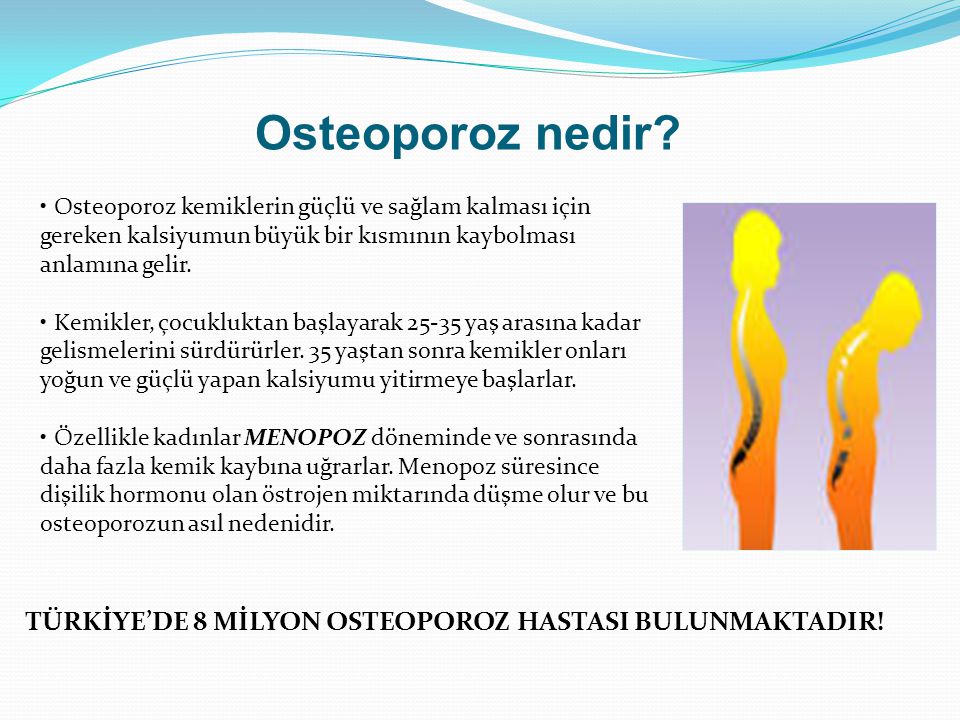 Osteoporoz nedir Osteoporoz kemiklerin güçlü ve sağlam kalması için gereken kalsiyumun büyük bir kısmının kaybolması anlamına gelir.