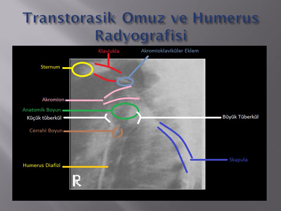 Transtorasik Omuz ve Humerus Radyografisi