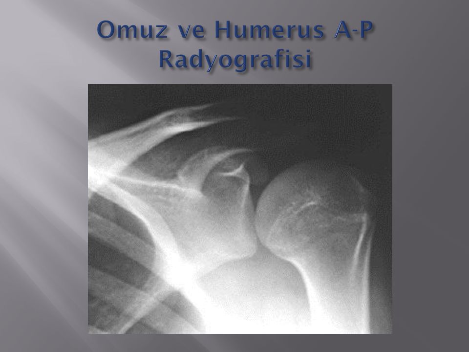 Omuz ve Humerus A-P Radyografisi