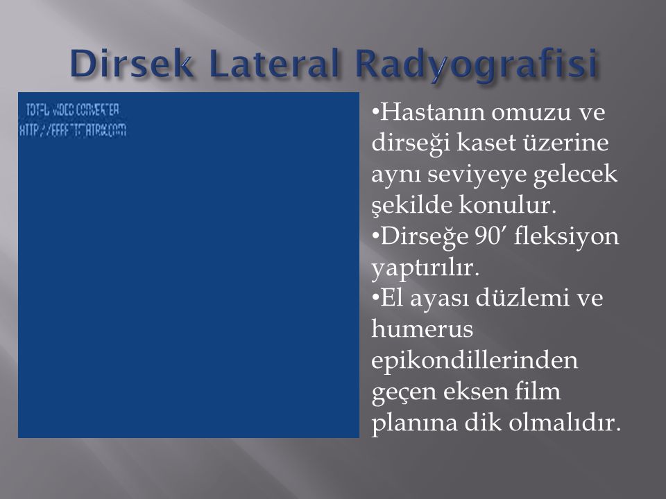 Dirsek Lateral Radyografisi