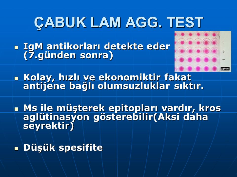ÇABUK LAM AGG. TEST IgM antikorları detekte eder (7.günden sonra)