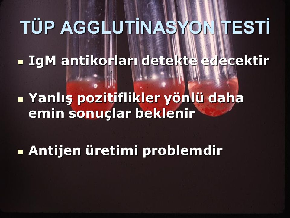 TÜP AGGLUTİNASYON TESTİ