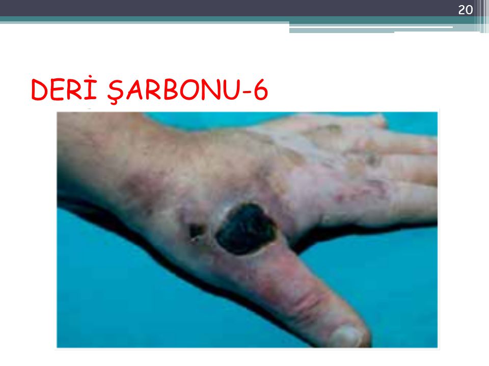 DERİ ŞARBONU-6