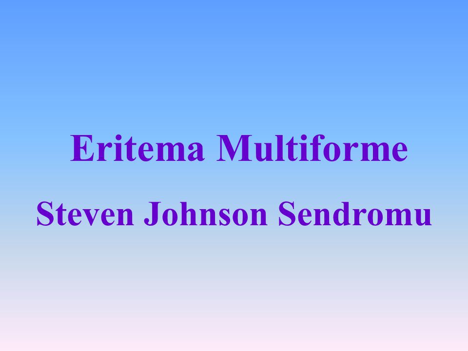 Steven Johnson Sendromu