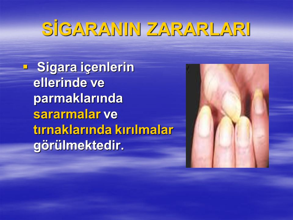 SİGARANIN ZARARLARI Sigara içenlerin ellerinde ve parmaklarında sararmalar ve tırnaklarında kırılmalar görülmektedir.
