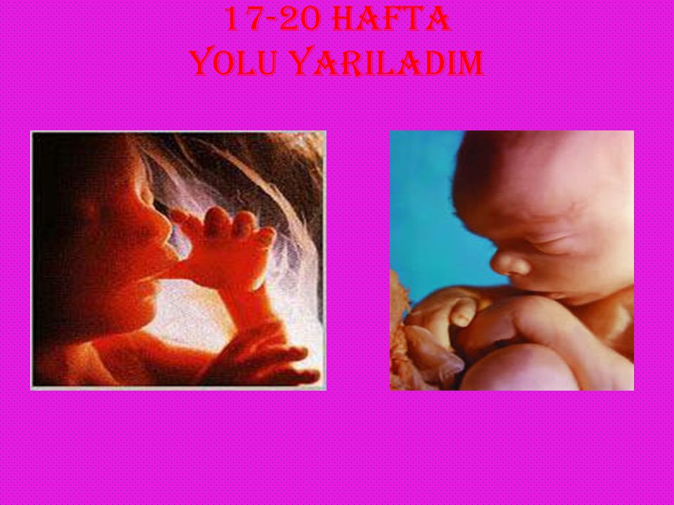 17-20 HAFTA YOLU YARILADIM