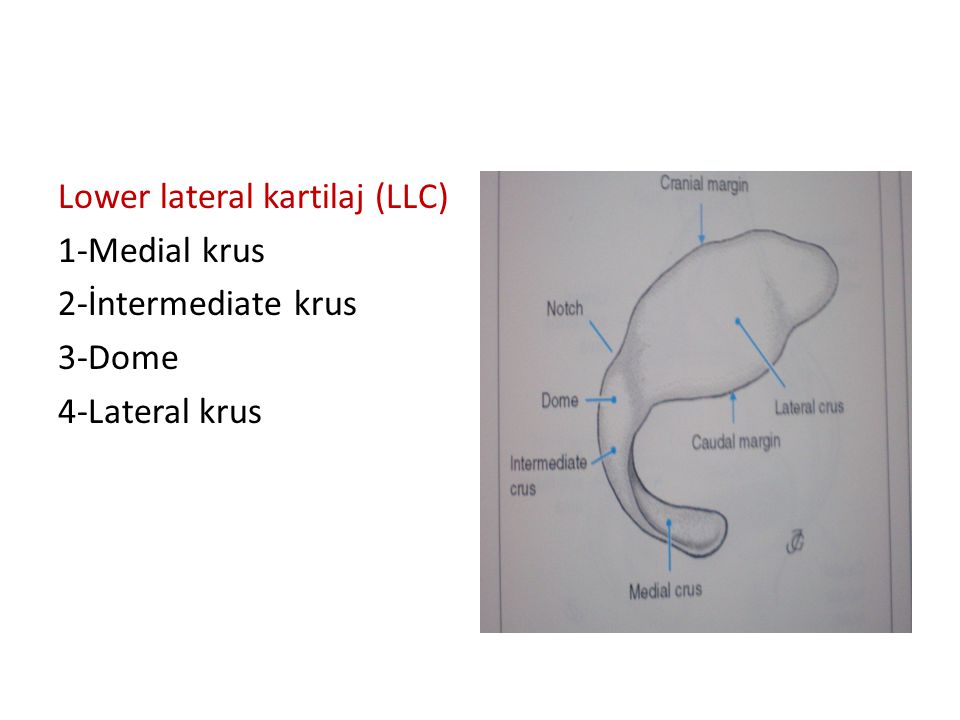 Lower lateral kartilaj (LLC)