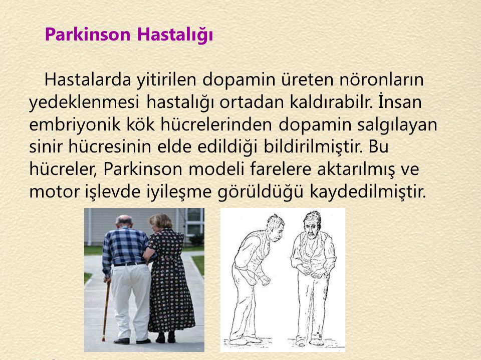 Parkinson Hastalığı