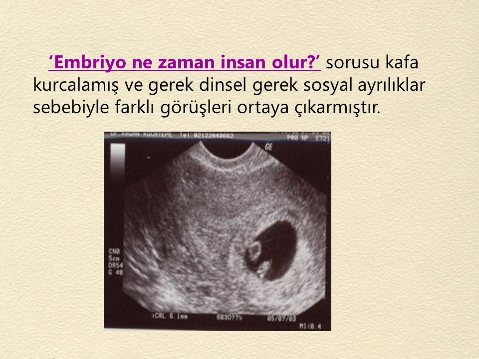 ‘Embriyo ne zaman insan olur
