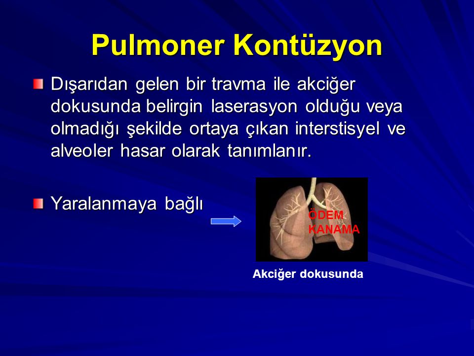 Pulmoner Kontüzyon