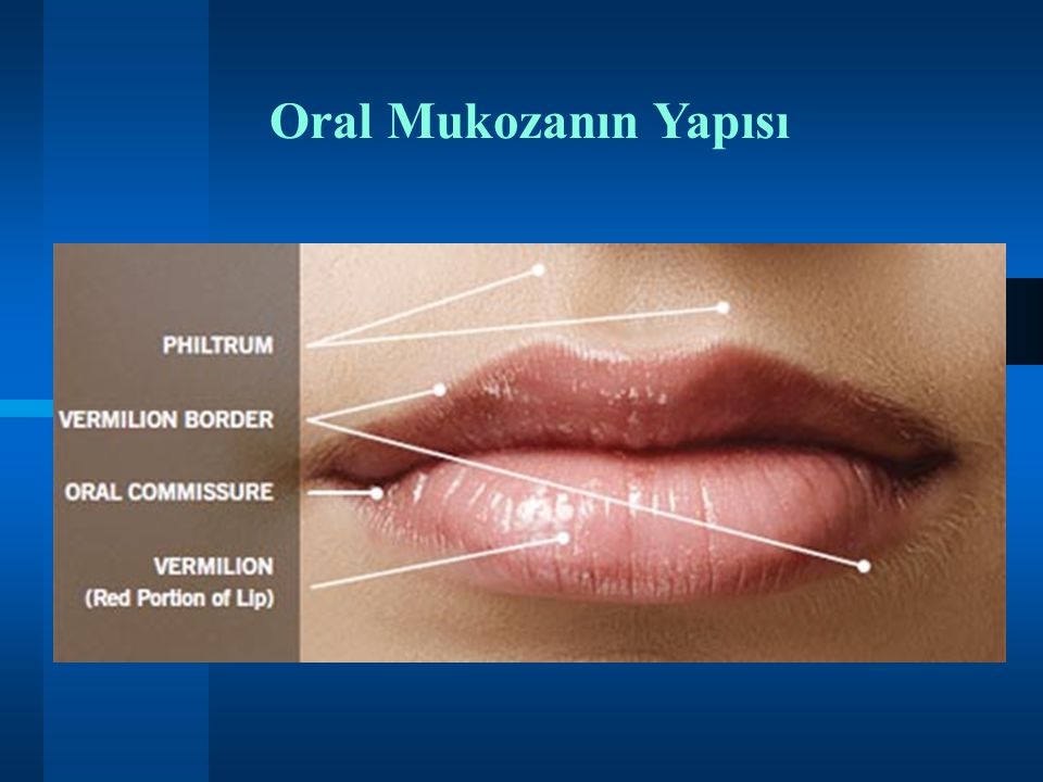 Oral Mukozanın Yapısı