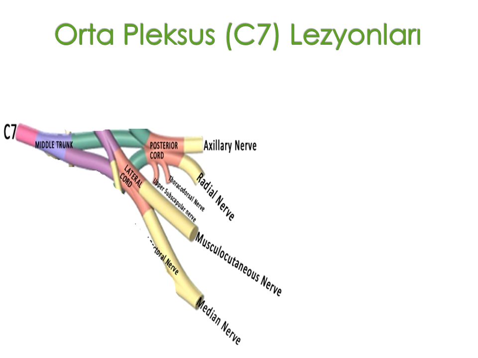 Orta Pleksus (C7) Lezyonları
