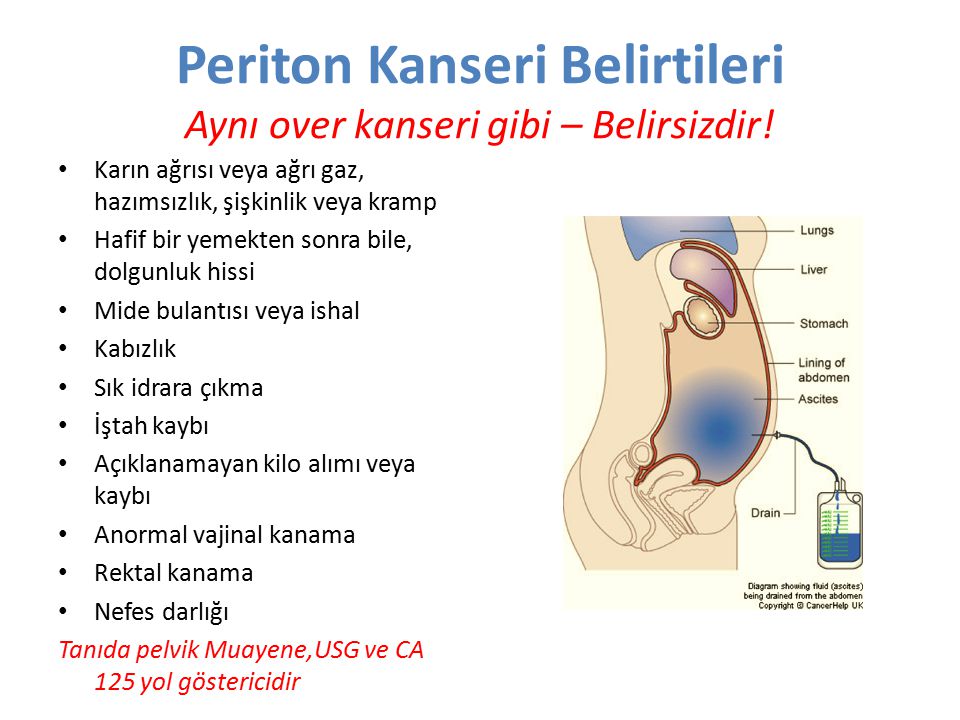 Vajinadan Gaz Çıkan Kadın