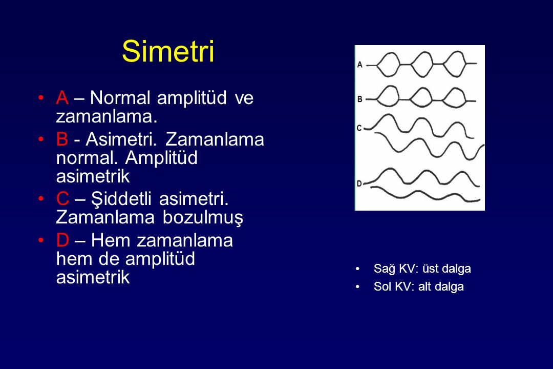 Simetri A – Normal amplitüd ve zamanlama.
