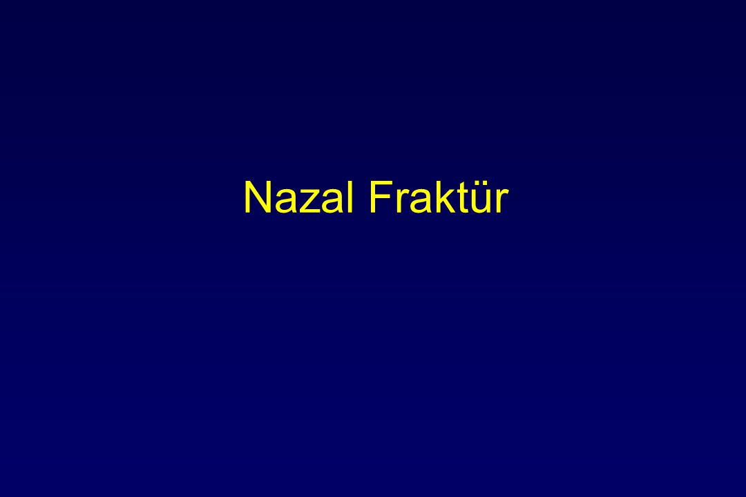 Nazal Fraktür