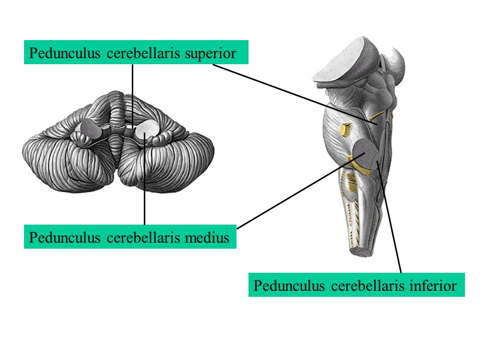 Средние ножки мозжечка. Pedunculus cerebellaris inferior. Нижние мозжечковые ножки (pedunculus cerebellaris inferior):. Верхние мозжечковые ножки (pedunculus cerebellaris Superior):. Pedunculus cerebellaris inferior перевод.